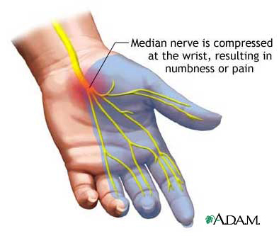 Median Nerve